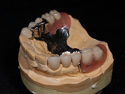 業務案内 技工物